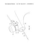 METHODS AND DEVICES FOR URETHRAL TREATMENT diagram and image