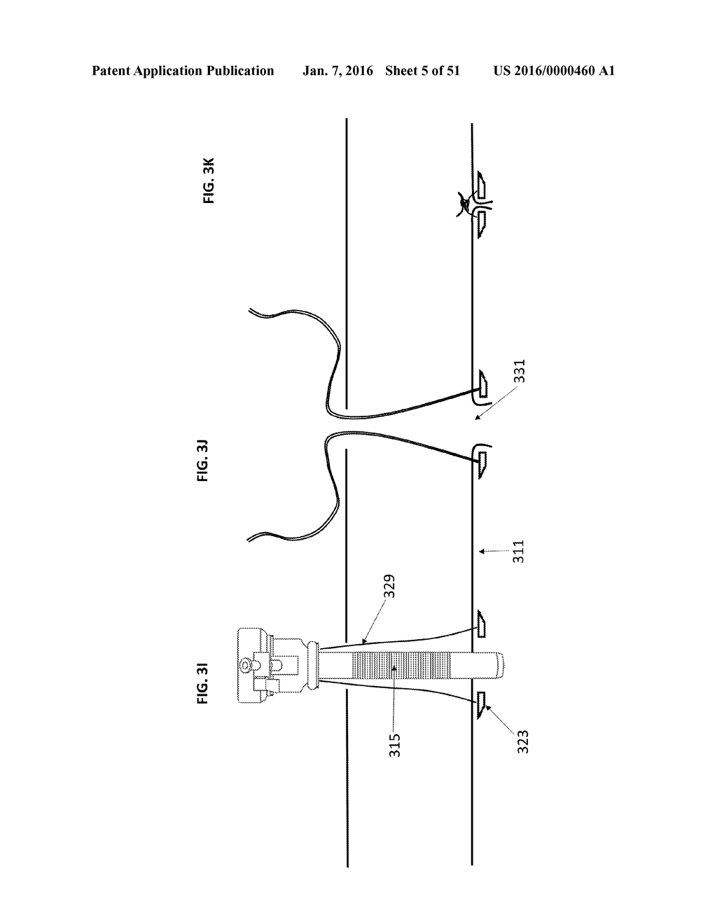 TROCAR AND WOUND CLOSURE DEVICE - diagram, schematic, and image 06