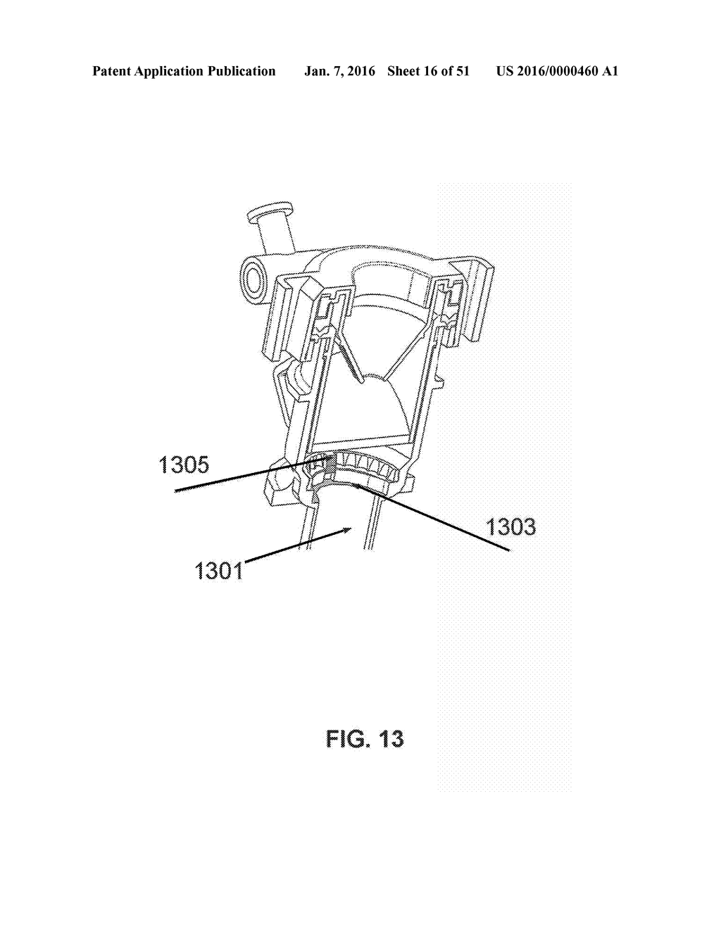 TROCAR AND WOUND CLOSURE DEVICE - diagram, schematic, and image 17