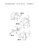 Instrument Port For Minimally Invasive Cardiac Surgery diagram and image