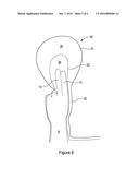 MEDICAL DEVICE FOR REDUCING BLEEDING diagram and image