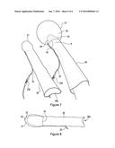 MEDICAL DEVICE FOR REDUCING BLEEDING diagram and image