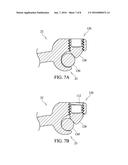 Transconnector for Coupling First and Second Spinal Fixation Elements diagram and image