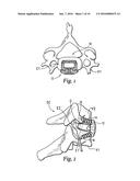 INTERBODY DEVICE AND PLATE FOR SPINAL STABILIZATION AND INSTRUMENTS FOR     POSITIONING SAME diagram and image