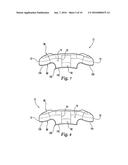 INTERBODY DEVICE AND PLATE FOR SPINAL STABILIZATION AND INSTRUMENTS FOR     POSITIONING SAME diagram and image