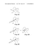 SACROILIAC JOINT FUSION SCREW AND METHOD diagram and image