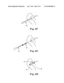 SACROILIAC JOINT FUSION SCREW AND METHOD diagram and image