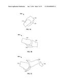 ANCHORING SYSTEMS AND METHODS FOR SURGERY diagram and image