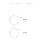 ANCHORING SYSTEMS AND METHODS FOR SURGERY diagram and image