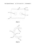 ANCHORING SYSTEMS AND METHODS FOR SURGERY diagram and image