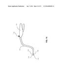 ANCHORING SYSTEMS AND METHODS FOR SURGERY diagram and image