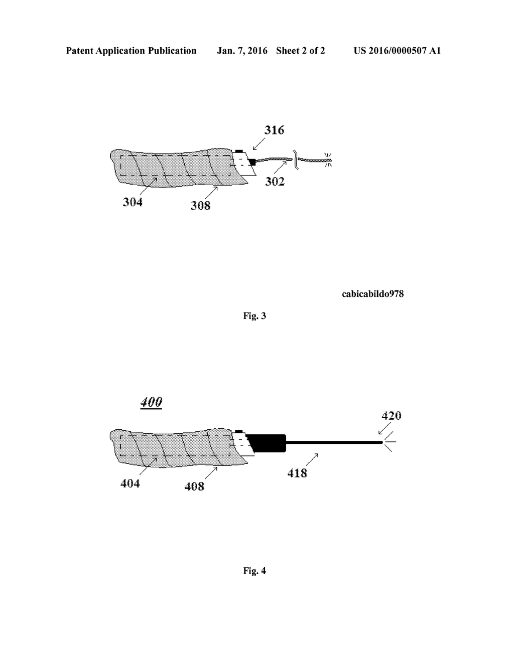 ENCLOSED LASER MEDICAL DEVICE/SYSTEM - diagram, schematic, and image 03