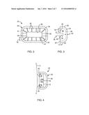 DEVICES, SYSTEMS, AND METHODS FOR ORTHODONTIC HARDWARE diagram and image