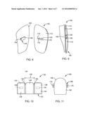 DEVICES, SYSTEMS, AND METHODS FOR ORTHODONTIC HARDWARE diagram and image