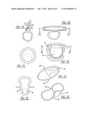 Intra-Vaginal Device For Fecal Incontinence diagram and image