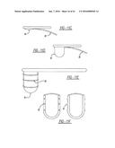 Intra-Vaginal Device For Fecal Incontinence diagram and image