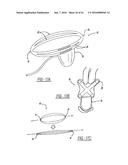 Intra-Vaginal Device For Fecal Incontinence diagram and image