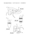 Intra-Vaginal Device For Fecal Incontinence diagram and image