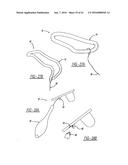 Intra-Vaginal Device For Fecal Incontinence diagram and image