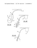 Intra-Vaginal Device For Fecal Incontinence diagram and image