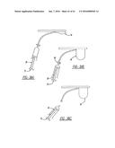 Intra-Vaginal Device For Fecal Incontinence diagram and image