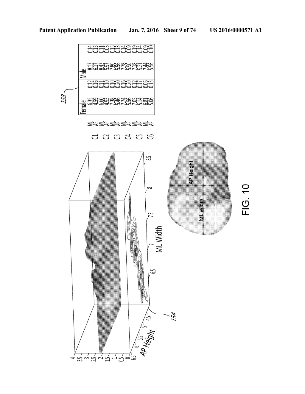 ETHNIC-SPECIFIC ORTHOPAEDIC IMPLANTS AND CUSTOM CUTTING JIGS - diagram, schematic, and image 10