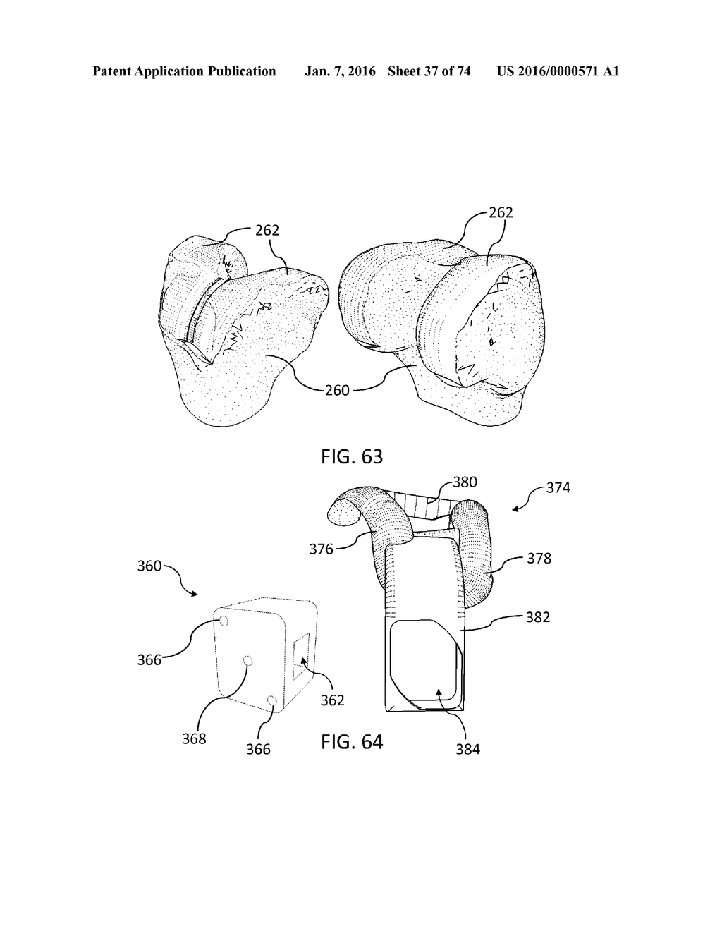 ETHNIC-SPECIFIC ORTHOPAEDIC IMPLANTS AND CUSTOM CUTTING JIGS - diagram, schematic, and image 38