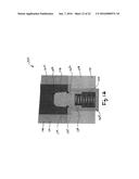 SPINE SURGERY METHOD AND IMPLANT diagram and image