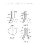 Stent System With Abutable C-Shaped Body Sections For Use in a Bifurcated     Body Vessel diagram and image