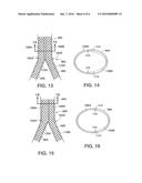 Stent System With Abutable C-Shaped Body Sections For Use in a Bifurcated     Body Vessel diagram and image