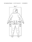 Method and Apparatus for Retention of Adipose Tissue diagram and image