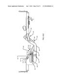 Surgical Table with Patient Support Having Flexible Inner Frame Supported     on Rigid Outer Frame diagram and image