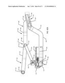 Surgical Table with Patient Support Having Flexible Inner Frame Supported     on Rigid Outer Frame diagram and image