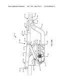 Surgical Table with Patient Support Having Flexible Inner Frame Supported     on Rigid Outer Frame diagram and image