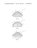 METHODS AND COMPOSITIONS FOR TREATMENT OF HALITOSIS diagram and image