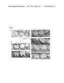 Methods for Increasing Oral Osteogenesis Using Lipoxin A4 (LXA4) and Its     Analogs diagram and image