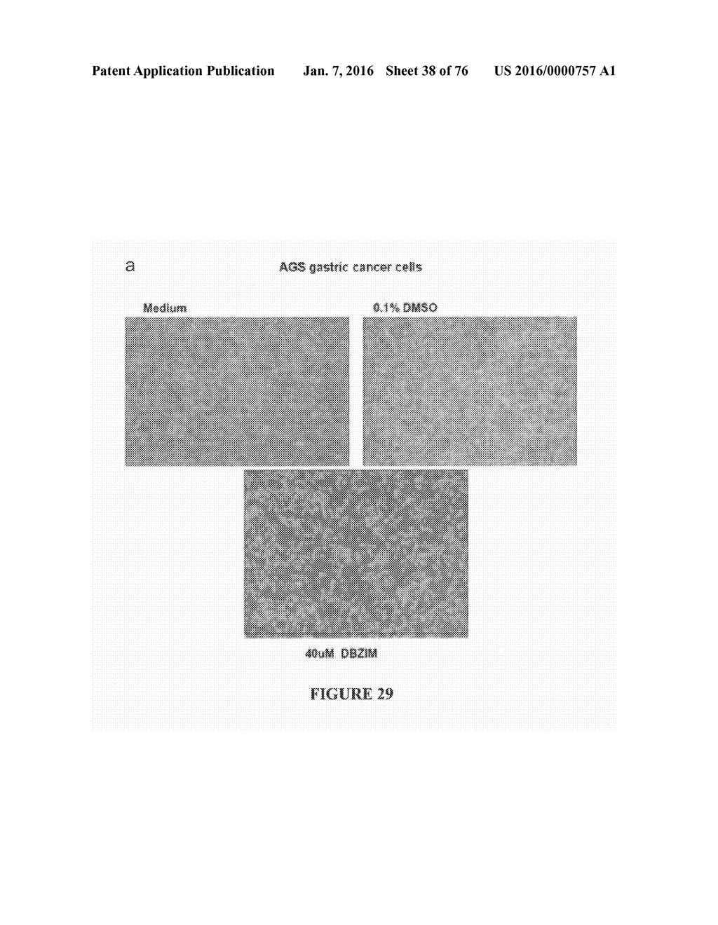 METHOD FOR TREATING FIBROSIS AND CANCER WITH IMIDAZOLIUM AND IMIDAZOLINIUM     COMPOUNDS - diagram, schematic, and image 39