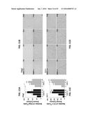 PAR1 MODULATION TO ALTER MYELINATION diagram and image