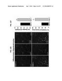 PAR1 MODULATION TO ALTER MYELINATION diagram and image