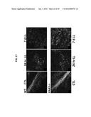 PAR1 MODULATION TO ALTER MYELINATION diagram and image