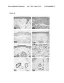 MODULATORS AND METHODS FOR THE TREATMENT OF ROSACEA diagram and image