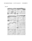 MODULATORS AND METHODS FOR THE TREATMENT OF ROSACEA diagram and image