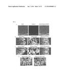 COMPOSITIONS AND METHODS RELATING TO INDUCTION OF INTESTINAL STEM CELL     HOMEOGENESIS AND/OR REGENERATION diagram and image