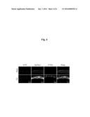 REAGENT FOR DIAGNOSIS OF OSTEOARTHRITIS COMPRISING PEPTIDE PROBE OF     APOPEP-1 diagram and image