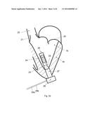 Ventricular assist device diagram and image