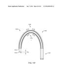 TOOL AND METHOD FOR USING SURGICAL ENDOSCOPE WITH SPIRAL LUMENS diagram and image