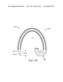 TOOL AND METHOD FOR USING SURGICAL ENDOSCOPE WITH SPIRAL LUMENS diagram and image