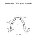 TOOL AND METHOD FOR USING SURGICAL ENDOSCOPE WITH SPIRAL LUMENS diagram and image