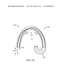 TOOL AND METHOD FOR USING SURGICAL ENDOSCOPE WITH SPIRAL LUMENS diagram and image