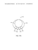 TOOL AND METHOD FOR USING SURGICAL ENDOSCOPE WITH SPIRAL LUMENS diagram and image